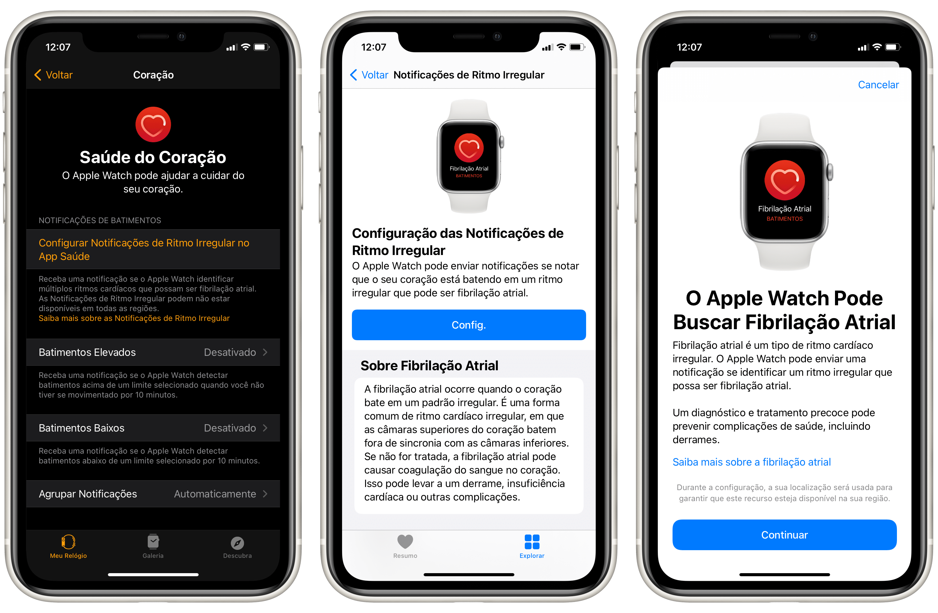 Ritmo irregular en Apple Watch