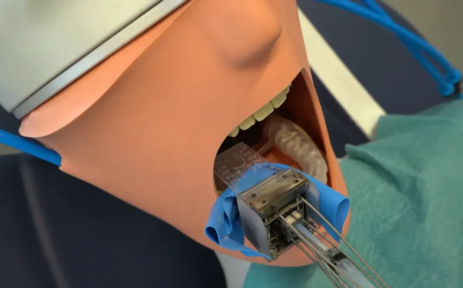Un robot del tamaño de un corcho prepara los dientes para la colocación de la corona